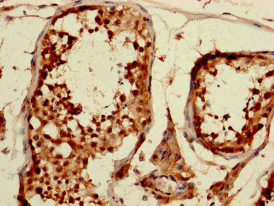 CDKN1A Antibody
