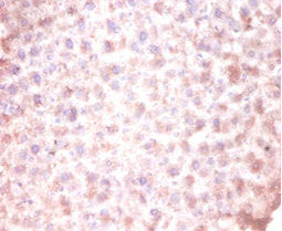 CDKN2AIPNL Antibody