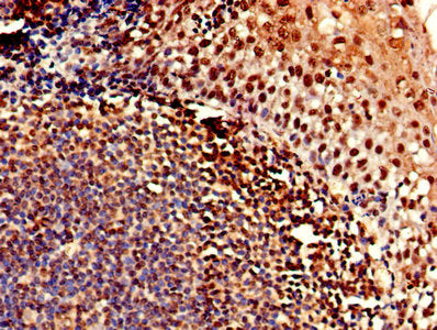 CLDN12 Antibody