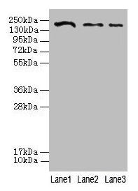 CLTCL1 Antibody
