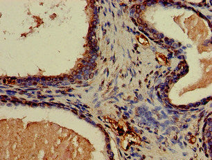 CNN3 Antibody