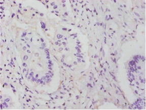RPL14 Antibody