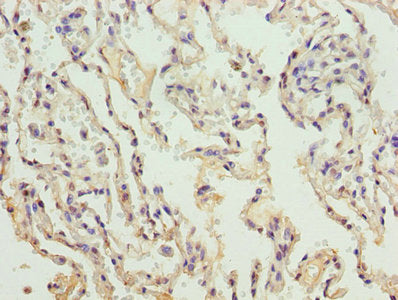 COL4A3 Antibody