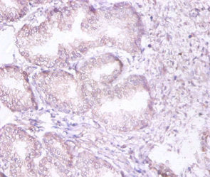 PSMD11 Antibody