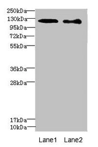 DIAPH2 Antibody