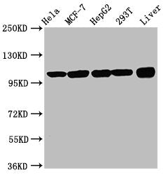ACTN4 Antibody