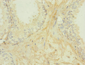 GIPR Antibody