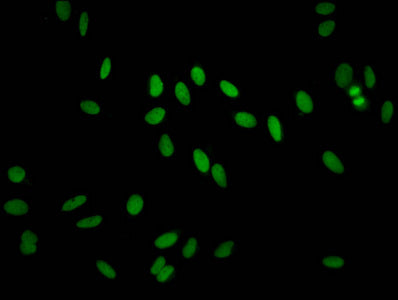 H2AFZ (Ab-11) Antibody