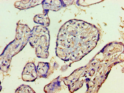 HDAC8 Antibody