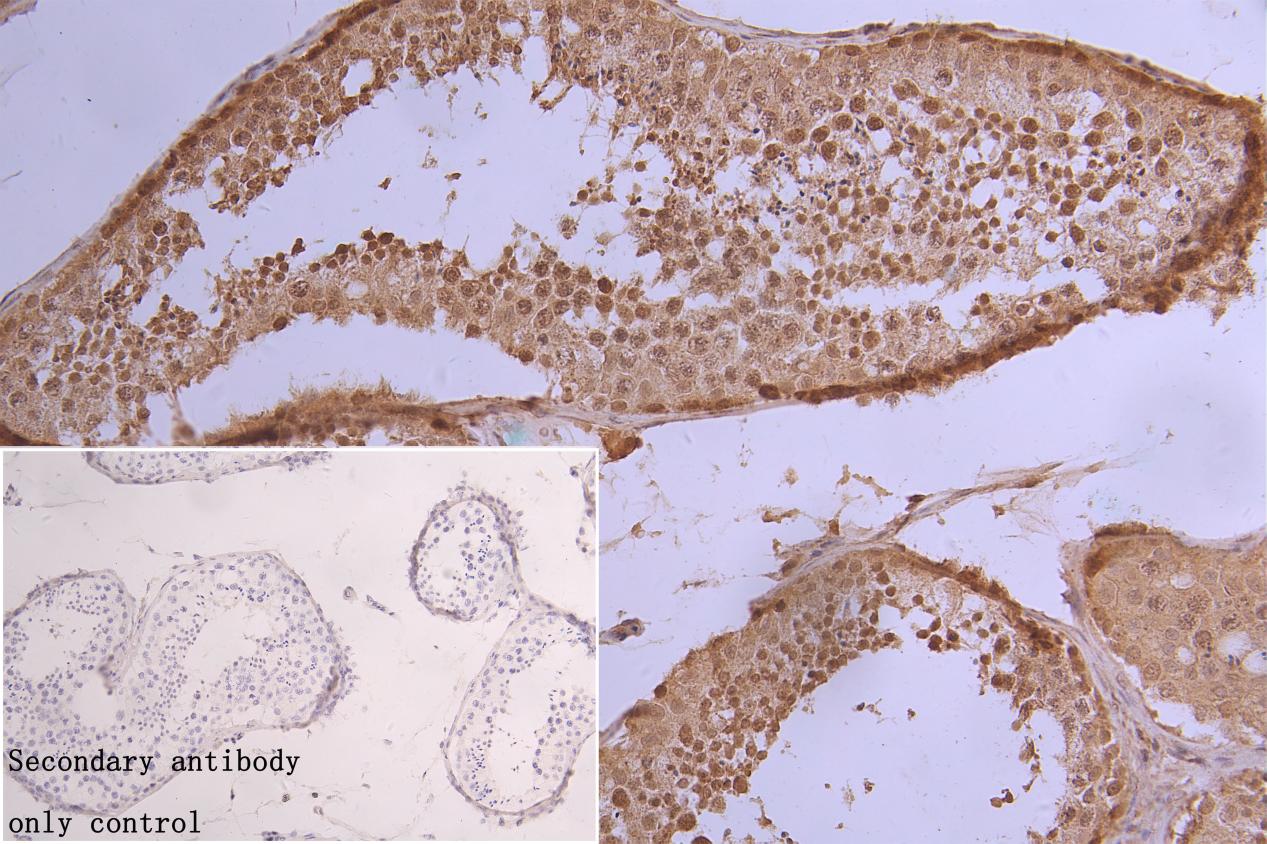 Phospho-HIST1H1B (T154) Antibody