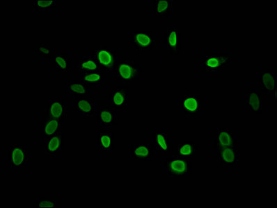 Mono-methyl-HIST1H1C (K118) Antibody