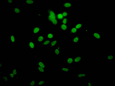 2-hydroxyisobutyryl-HIST1H1C (K51) Antibody