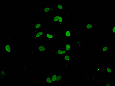 HIST1H1E (Ab-147) Antibody