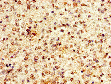 HIST1H1E (Ab-63) Antibody