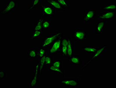 Di-methyl-HIST1H2AG (R11) Antibody