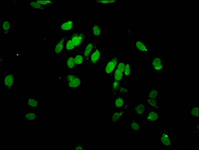 2-hydroxyisobutyryl-HIST1H2AG (K95) Antibody
