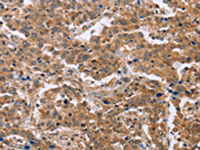 EPDR1 Antibody