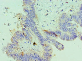 IGFBP4 Antibody