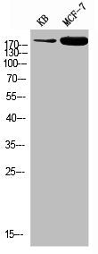 Phospho-IRS1 (Y896) Antibody
