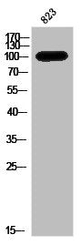 AR Antibody