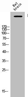 Phospho-ITPR1 (S1764) Antibody