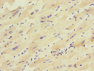 KCNJ4 Antibody