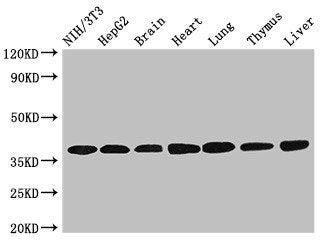 LDHC Antibody