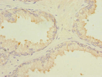 MARCKSL1 Antibody