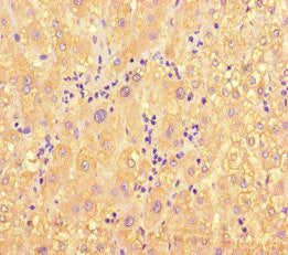 ME1 Antibody
