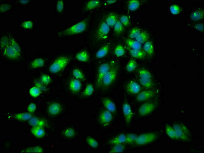 ARHGEF7 Antibody
