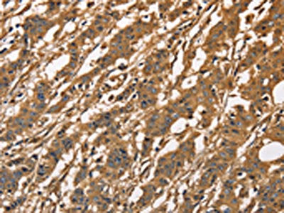 CAPZA3 Antibody