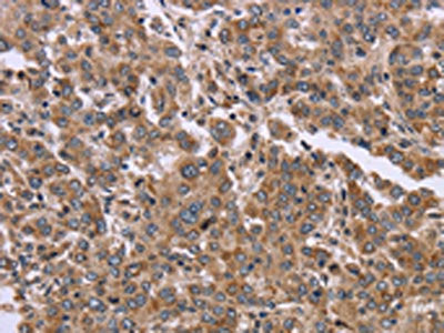 FAM3B Antibody