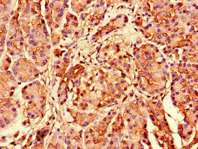 RPS26 Antibody