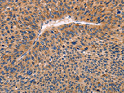 ADAMDEC1 Antibody