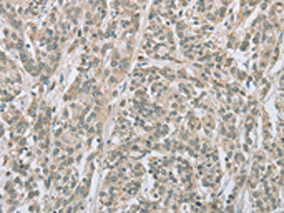 EDA2R Antibody