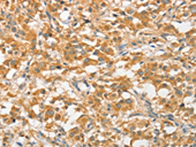 ATG5 Antibody