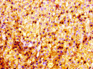 PNMT Antibody