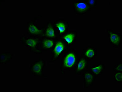 PRMT1 Antibody