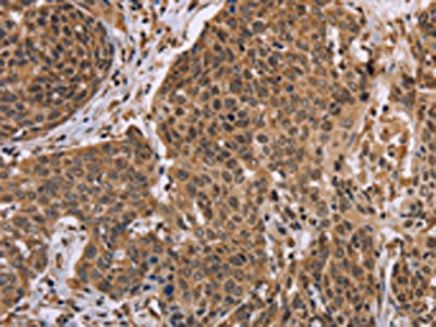 EDN2 Antibody