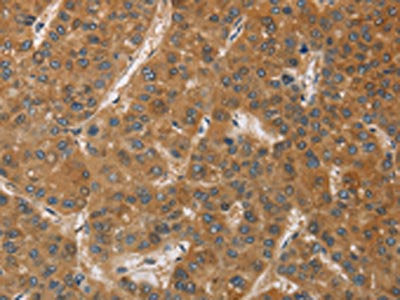 DCTN1 Antibody