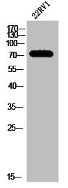 SPHK2 Antibody