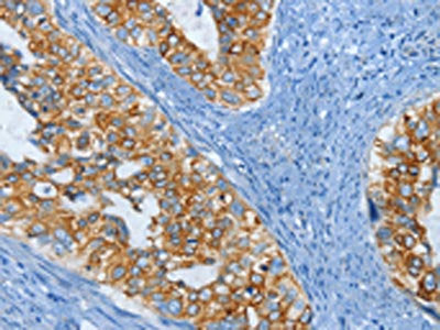 KRT81 Antibody