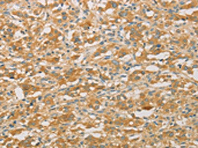 PRPSAP1 Antibody
