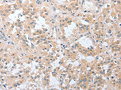 LY96 Antibody