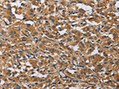 BMP15 Antibody