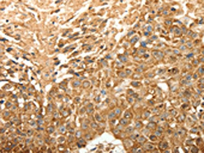 SLC25A11 Antibody