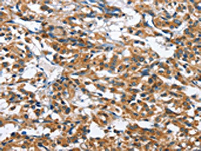 BPI Antibody