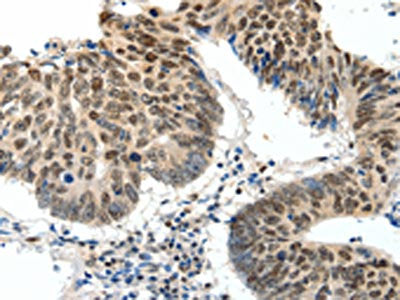 TOP2A Antibody