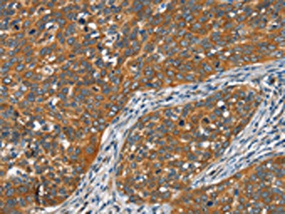 FZD1 Antibody