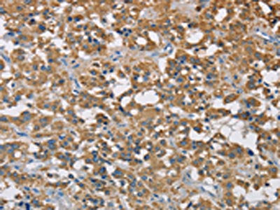 CST2 Antibody